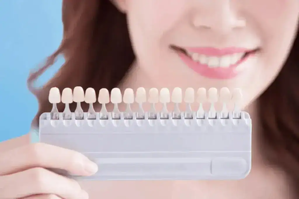 Is It Safe to Whiten a Tooth That’s Had a Lot of Dental Work Already Warwickshire